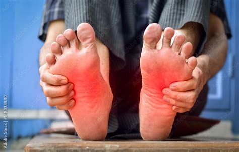 Tingling and burning sensation in feet of Asian man. Foot pain. Sensory ...
