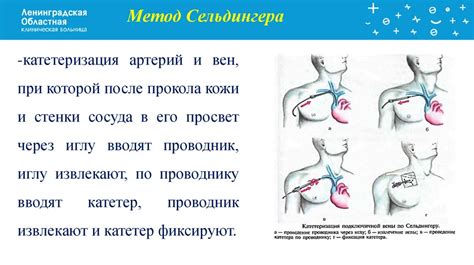Сестринский уход и введение центрального венозного катетера ...