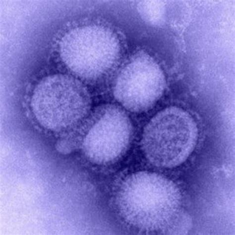 A/H1N1