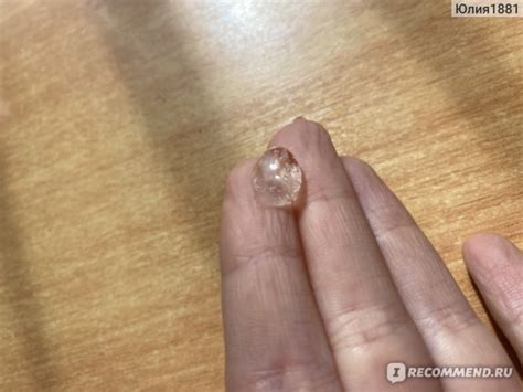 Гель для лица L'Oreal Paris Гиалурон Эксперт гель-концентрат - «Бомба ...