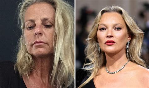 Ulrika Jonsson ‘fan of nudity’ as she explains she asked surgeon for