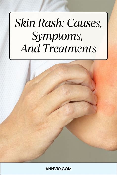 skin rash  symptoms  treatments