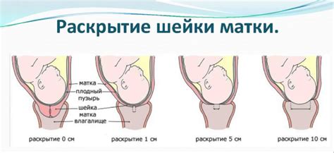 Когда открывается шейка матки перед родами симптомы - Здоровый ребенок