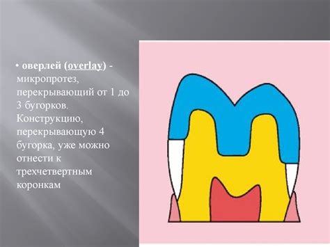 Замещение дефектов коронки зуба коронковыми вкладками - online presentation