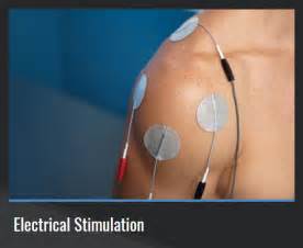 ELECTRICAL STIMULATION - South Miami Sports Medicine