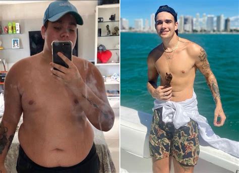 Cirurgia Bariatrica Antes E Depois Flacidez - Rafa Almeida comemora dois anos de cirurgia bariátrica: "Só sabia de ...