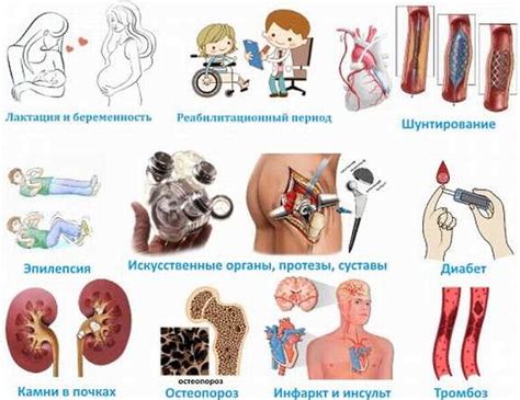 Виброплатформа для похудения. Отзывы, польза и вред, как заниматься ...