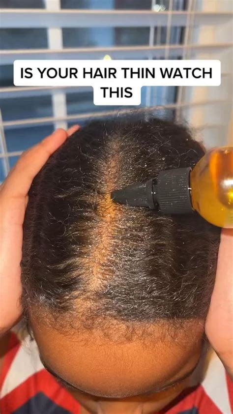 how long does hair growth oil take to work