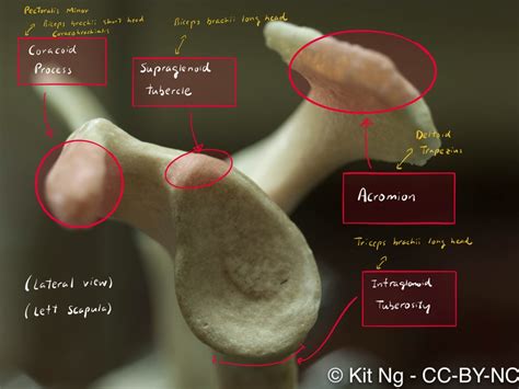 supraglenoid tubercle  scapula