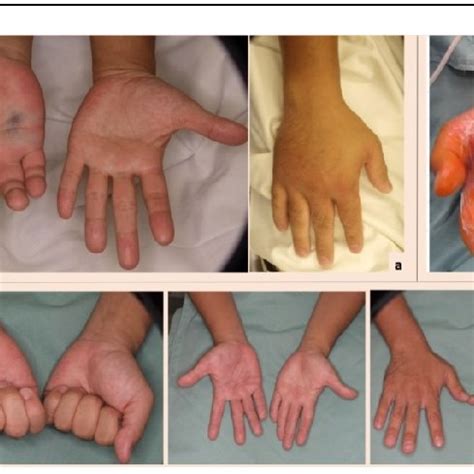 clinical   case   arrival  note  sting wound