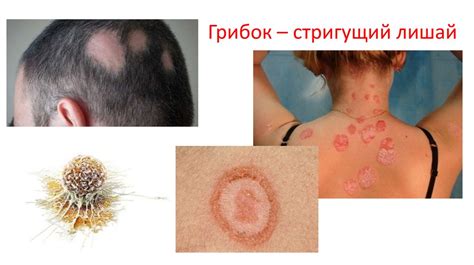 Травмы и болезни кожи - презентация онлайн