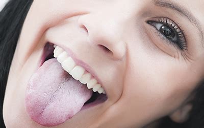 Avoiding the Problem of Dry Mouth