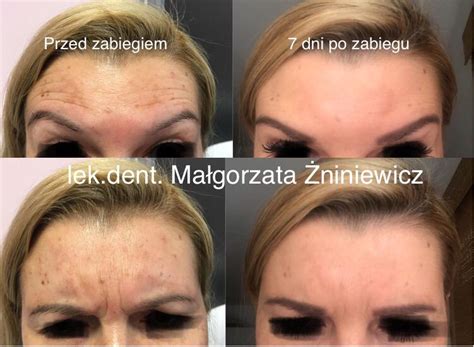 Laser - Magiczna Klinika - Najlepsi lekarze w najlepszych cenach