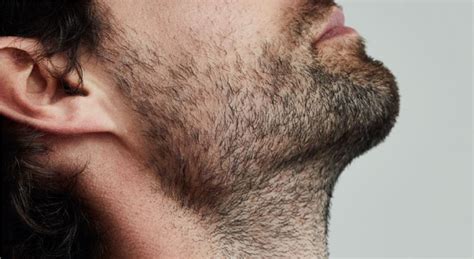 enorme quiste de pelo encarnado