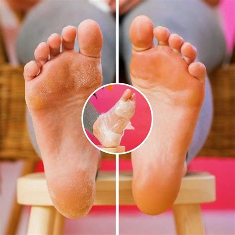 meo lam dep don gian  ich bat ngo tuy  hoi ky la bloganchoi