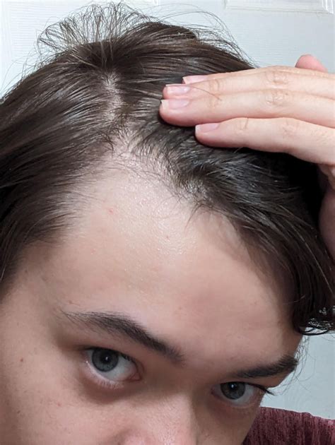 This haircut for men with bangs trick fixes a receding hairline 16