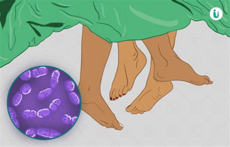 Trichomoniasis symptoms, causes, treatment, medicine, prevention, diagnosis