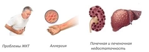 Свечи Мелоксикам: инструкция по применению, цена