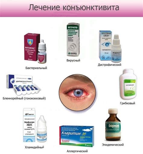 Глазные мази: от воспаления, от мешков под глазами, от отеков, от ...