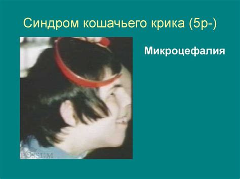 Хромосомные болезни - презентация онлайн