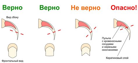 Как подстричь когти кошке в домашних условиях