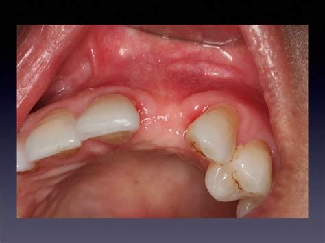 Locals are debating oak ridge cemetery preservation and costs 8