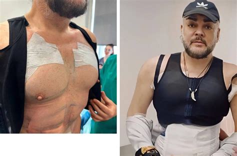 Филипп Киркоров сделал себе операцию на грудь и пресс, чтобы у него ...