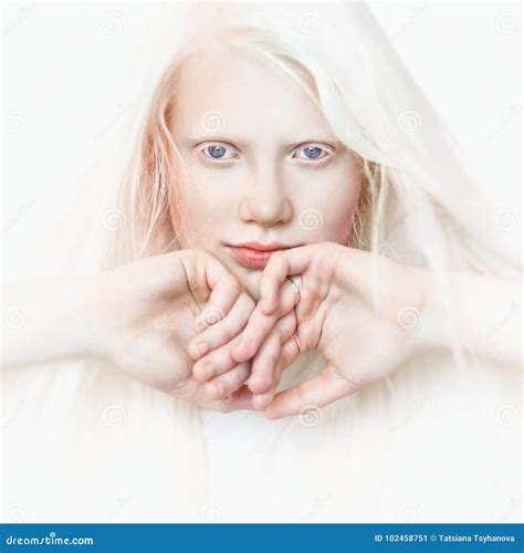 Albino Girl with White Pure Skin, Blue Eyes and White Hair. Photo Face
