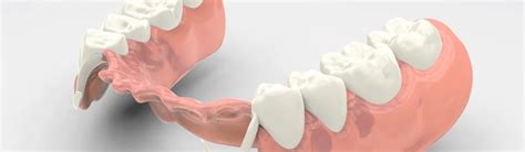 Протезирование жевательных зубов | DentaBravo