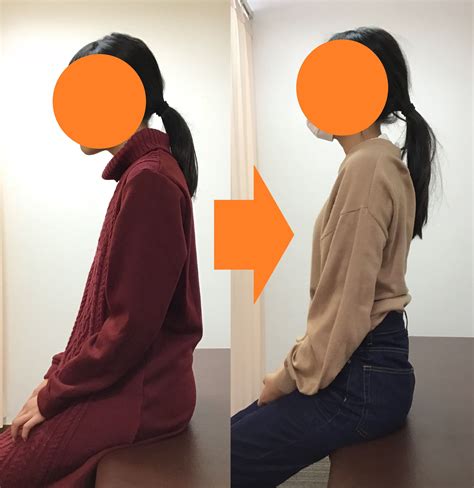 【整体】中学生女の子の猫背によるスマホ首｜東大阪市高井田の整体院「姿勢矯正院スタイルケア」 | 姿勢矯正院スタイルケア