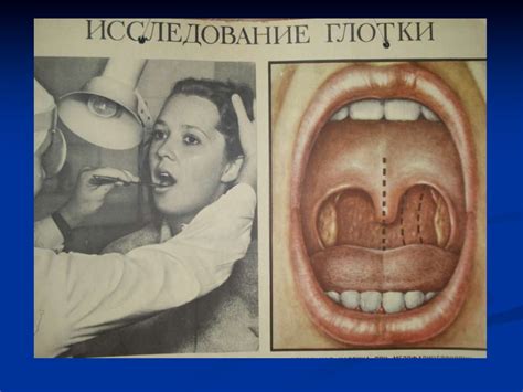 История и пути развития оториноларингологии. Значение ЛОР-органов в ...