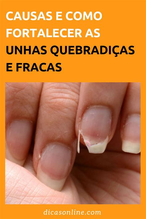 O Que Fazer Quando As Unhas Quebram - 4 causas das unhas fracas e quebradiças e como fortalecer para ...