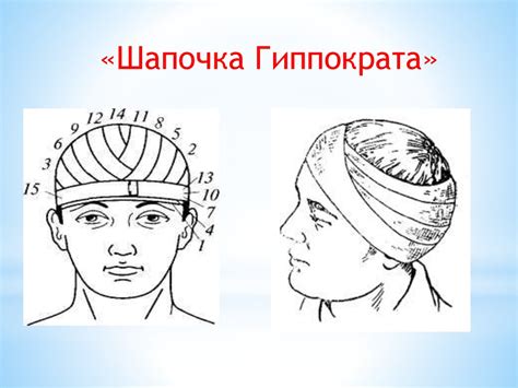 Десмургия. Таңғыш түрлері - презентация онлайн