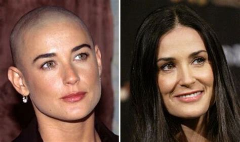 oz angeles balding celebrities