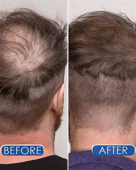 Particle Hair Revival Kit: Does It Really Work? An In-Depth Review