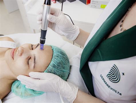 Dermapen - DERMAREVOLTA