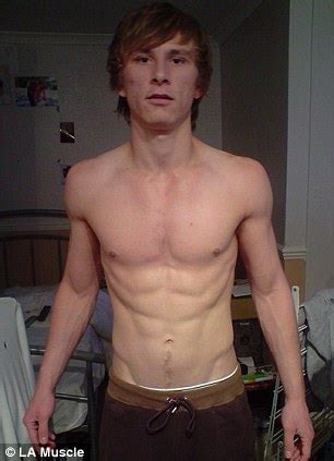 anorexic man  lived    apple  day recovers