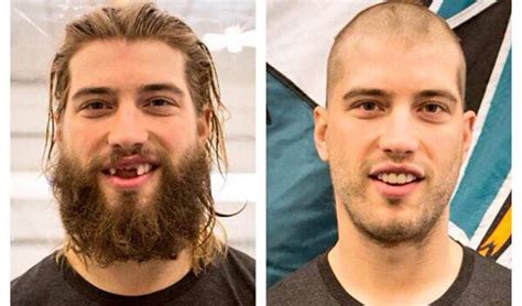 Brent Burns Shaves His Infamous Hair & Beard For A Good Cause