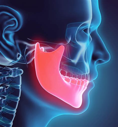 Jaw Bone Health San Diego CA | Teeth & Jaw Health Torrey Pines CA