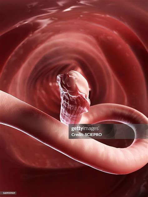 Roundworm Artwork High-Res Vector Graphic - Getty Images