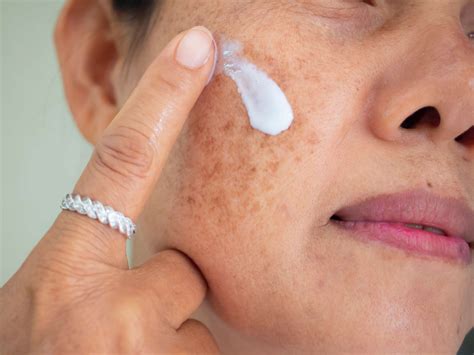 What is tranexamic acid? - Reviva Labs
