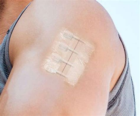 Стяжки для стягивания краёв резаных ран ZipStitch — Шопинг Блог