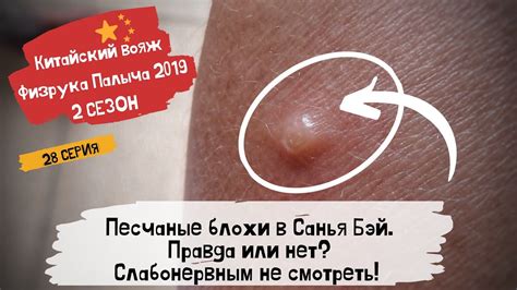 Китай Хайнань Санья 2019/ Песчаные блохи в Санья Бэй укусы/ ТРЭШ и ШОК ...