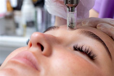 Microneedling Bilder – Durchsuchen 4,795 Archivfotos, Vektorgrafiken ...