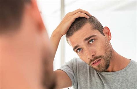 7 Hair Loss Prevention Tips For Men - Copsse