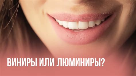 Установка виниров. Зубной техник. - YouTube