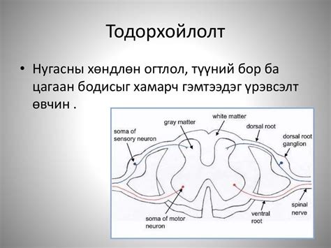 миелит