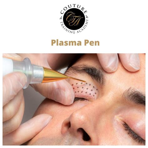 Plasma Fibroblast - Couture Training Academy