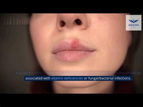 Health tech on LinkedIn: Unlocking the Secrets of Deep Health Issues ...