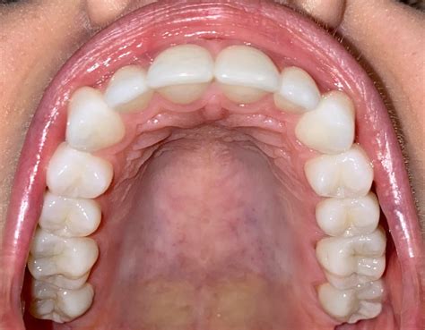 schedule   virtual consult saddle creek orthodontics dr kyle